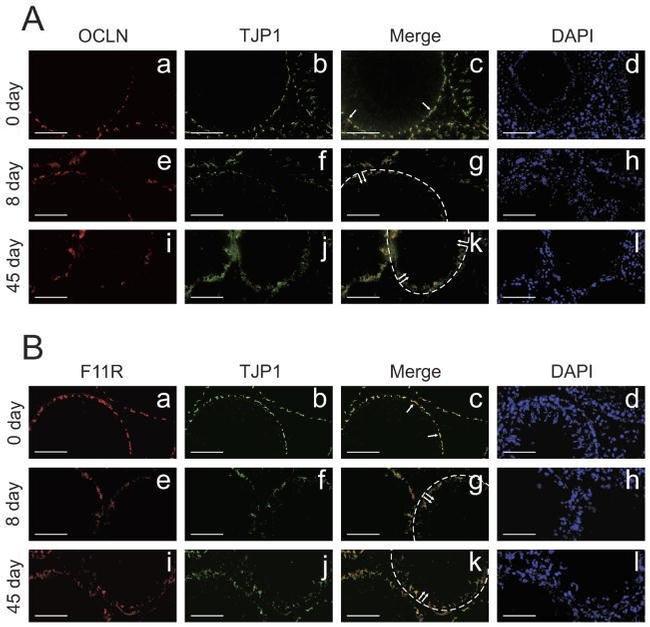 ZO-1 Antibody in Immunohistochemistry (IHC)