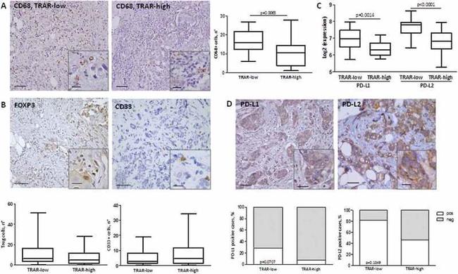 FOXP3 Antibody in Immunohistochemistry (IHC)