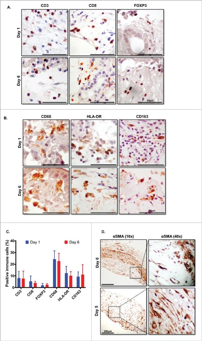 FOXP3 Antibody in Immunohistochemistry (IHC)