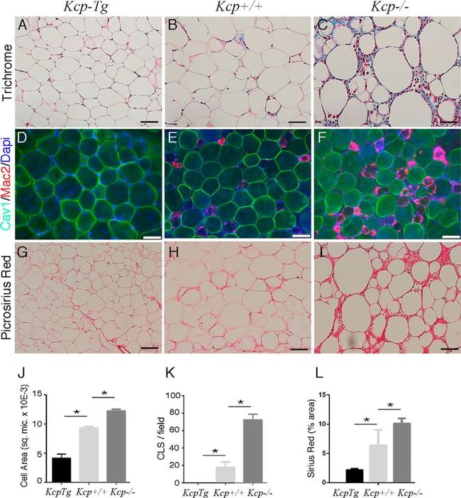 Galectin 3 Antibody in Immunohistochemistry (IHC)