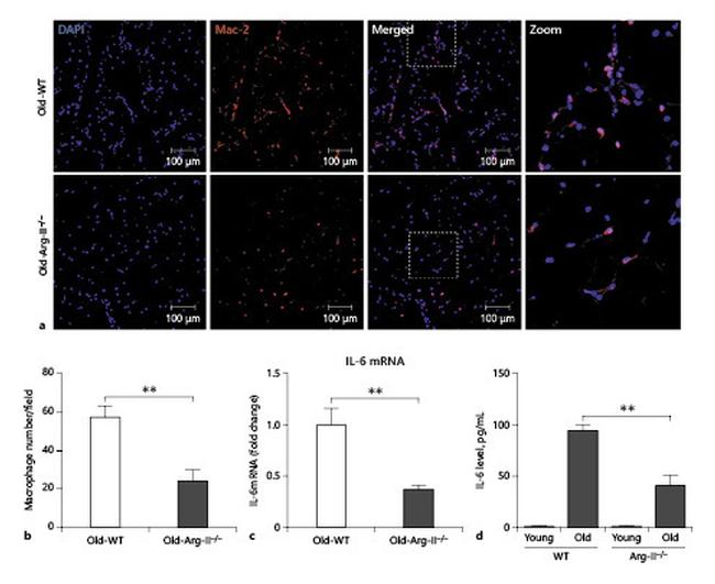 Galectin 3 Antibody in Immunohistochemistry (IHC)