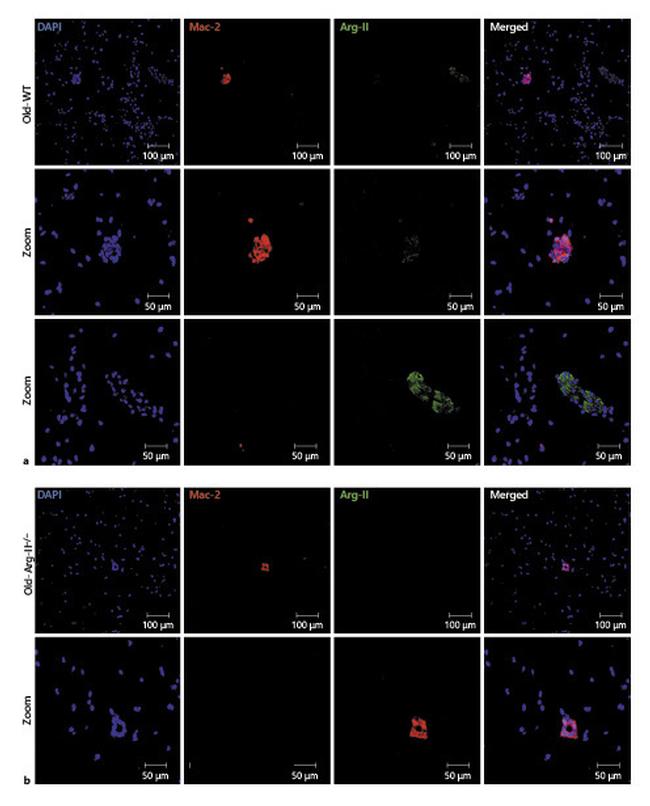 Galectin 3 Antibody in Immunohistochemistry (IHC)