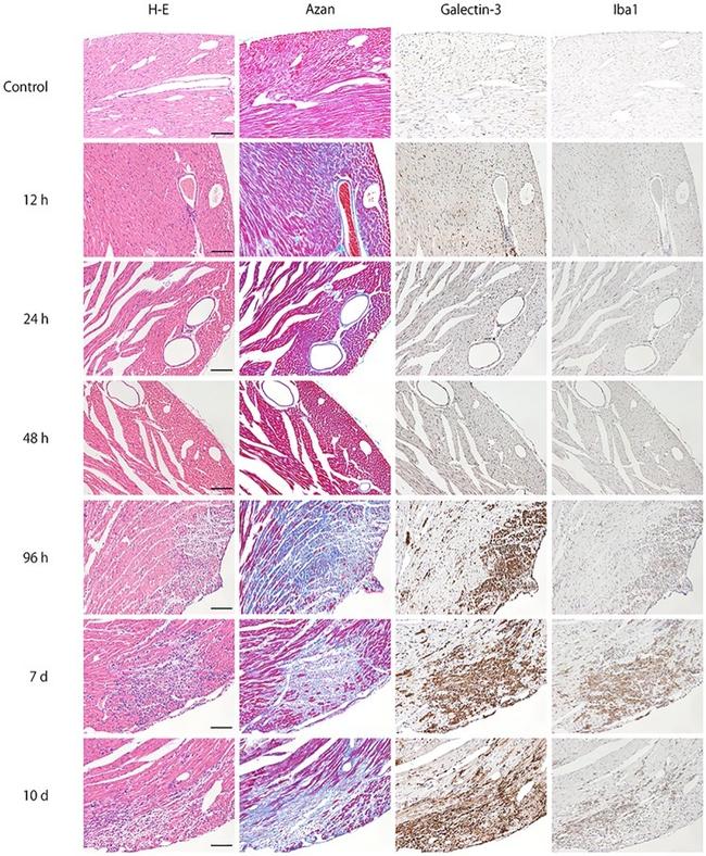 Galectin 3 Antibody in Immunohistochemistry (IHC)