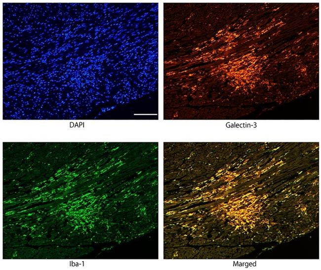 Galectin 3 Antibody in Immunohistochemistry (IHC)