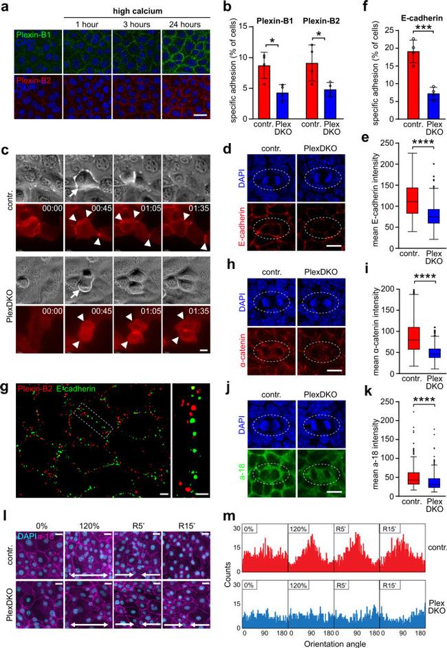 Plexin-B2 Antibody in Immunocytochemistry (ICC/IF)