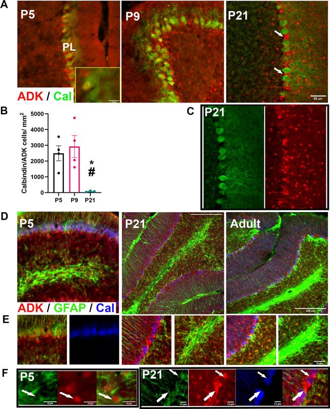 GFAP Antibody in Immunohistochemistry (IHC)