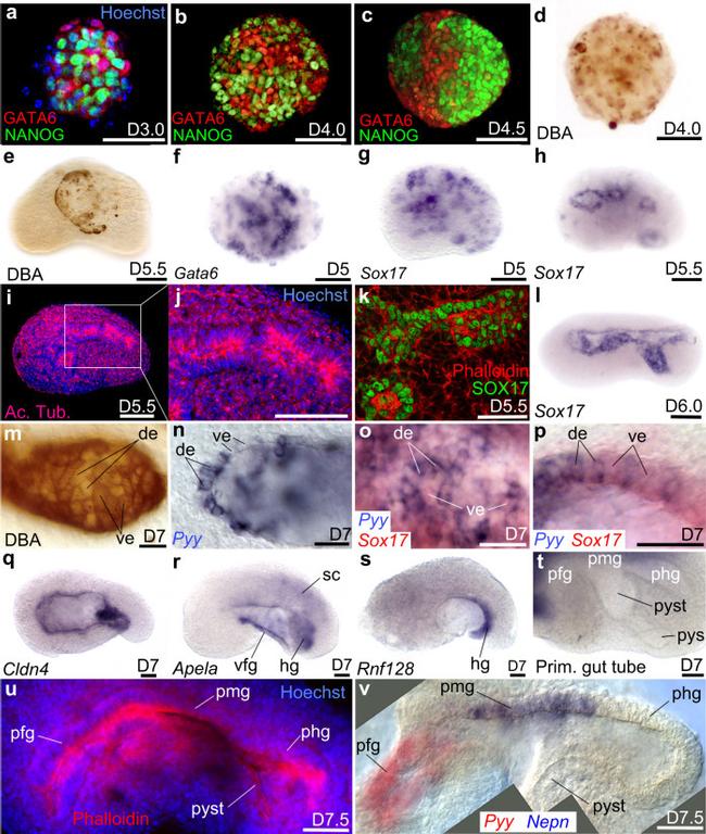 GATA6 Antibody in Immunohistochemistry (IHC)