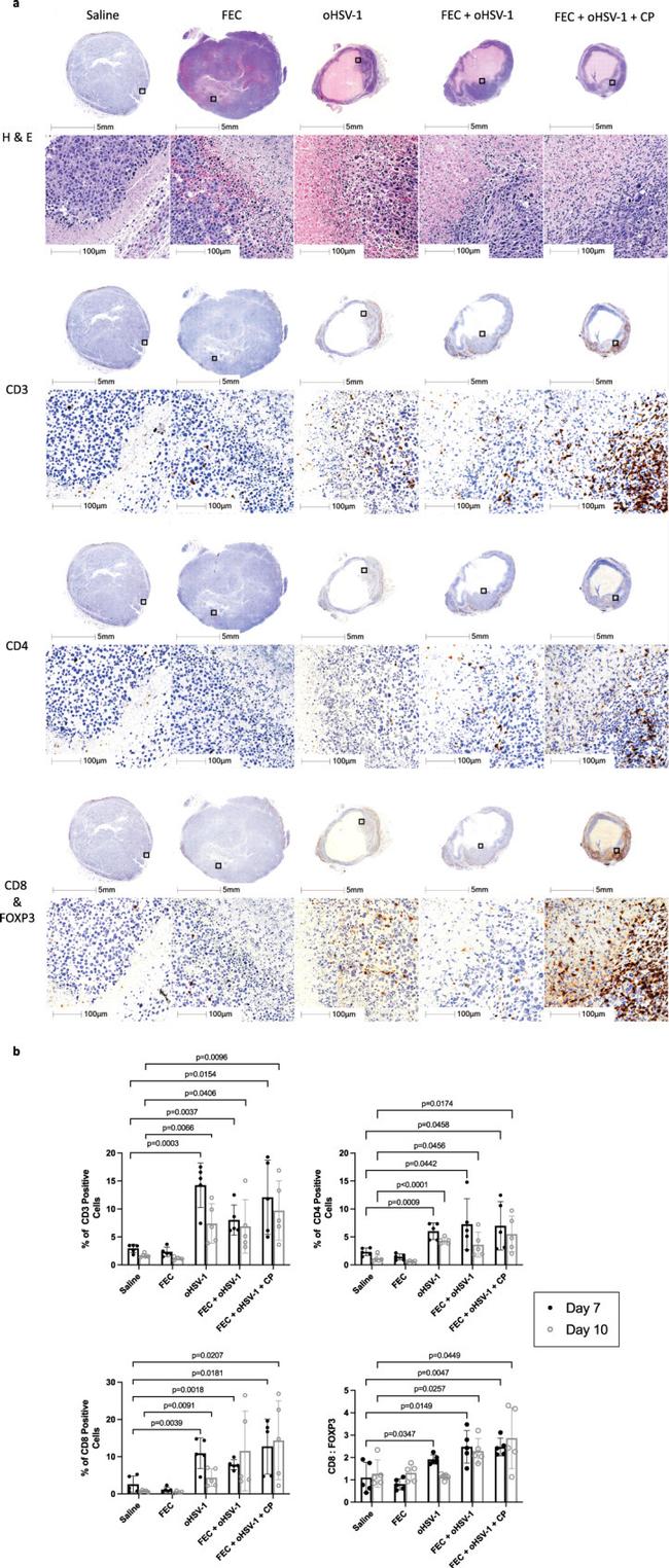 CD4 Antibody in Immunohistochemistry (IHC)