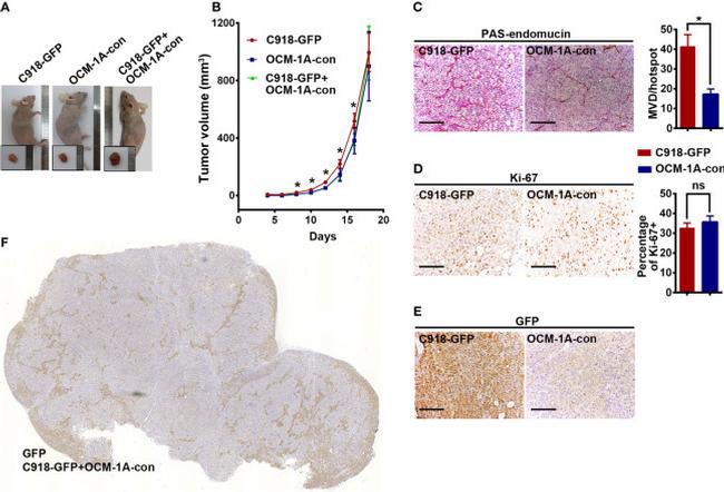 Endomucin Antibody in Immunohistochemistry (IHC)