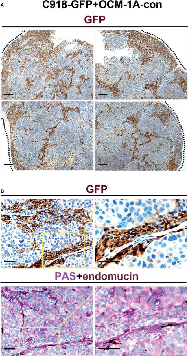 Endomucin Antibody in Immunohistochemistry (IHC)