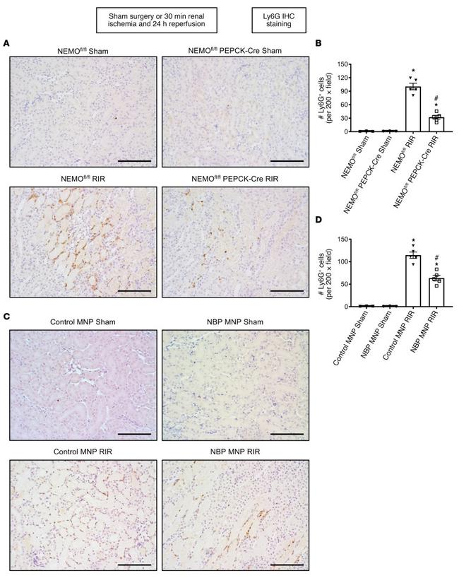 Ly-6G/Ly-6C Antibody in Immunohistochemistry (IHC)