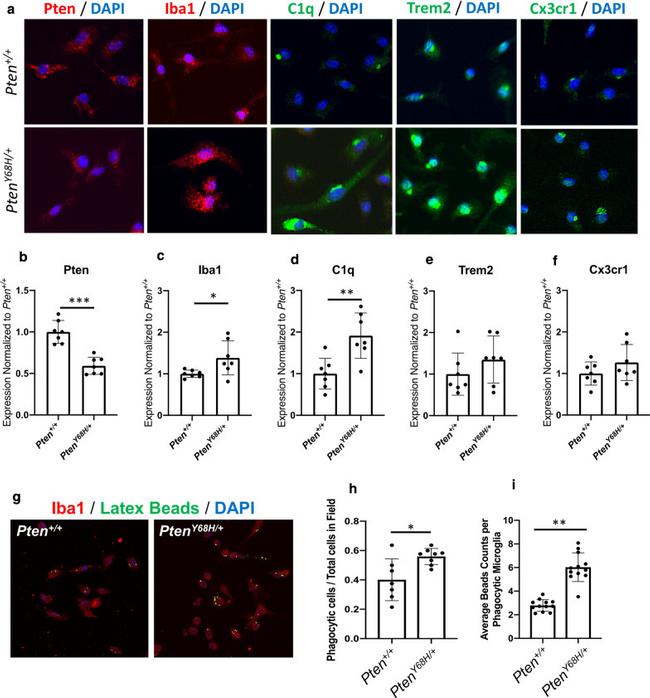 CX3CR1 Antibody in Immunocytochemistry (ICC/IF)