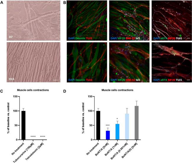 Myosin 4 Antibody in Immunocytochemistry (ICC/IF)