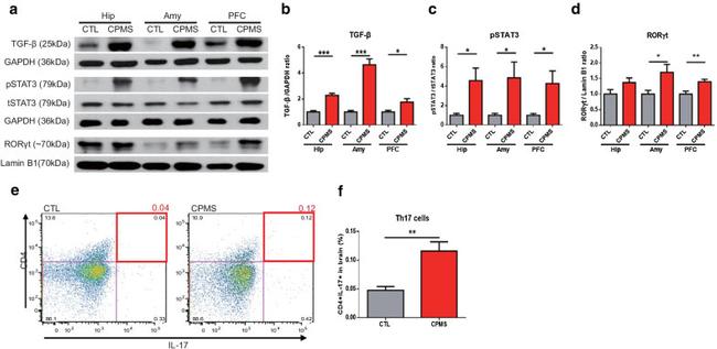 ROR gamma (t) Antibody in Western Blot (WB)