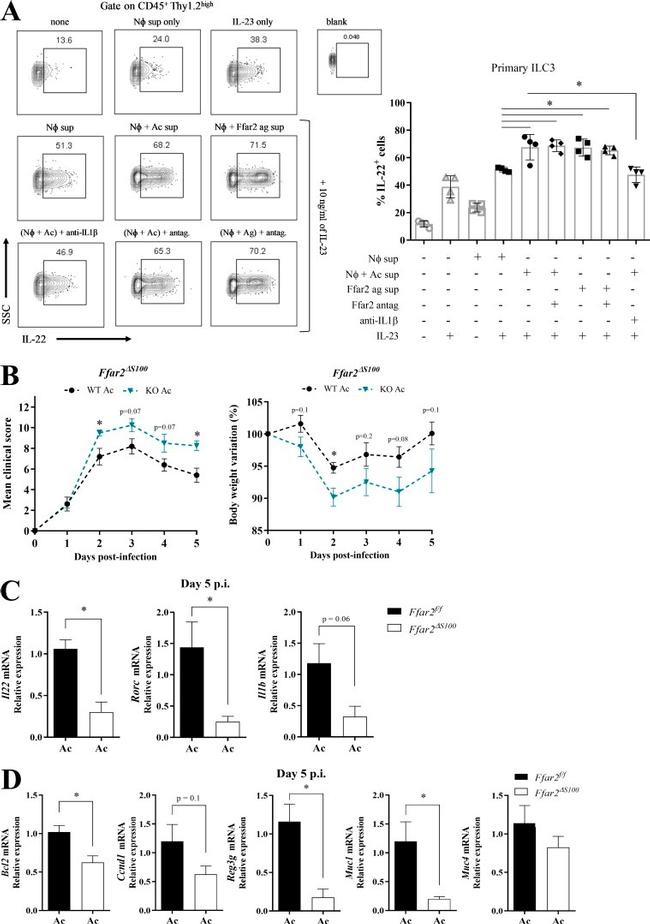 IL-1 beta Antibody in Neutralization (Neu)