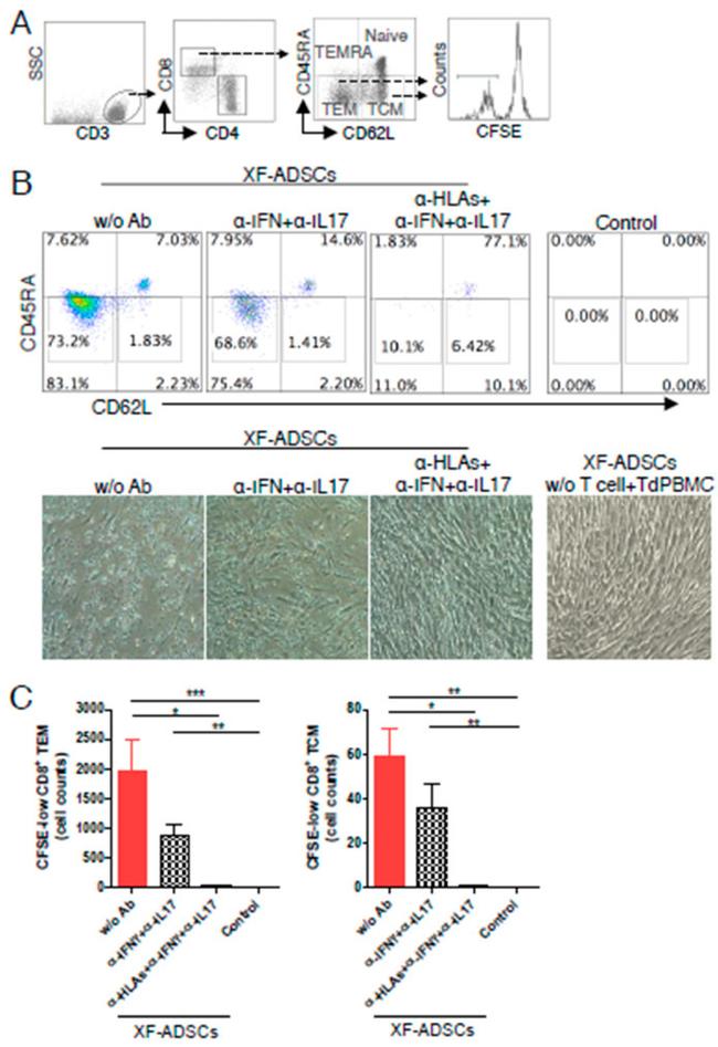 IFN gamma Antibody in Neutralization (Neu)