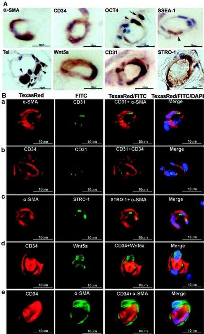 STRO-1 Antibody in Immunohistochemistry (IHC)