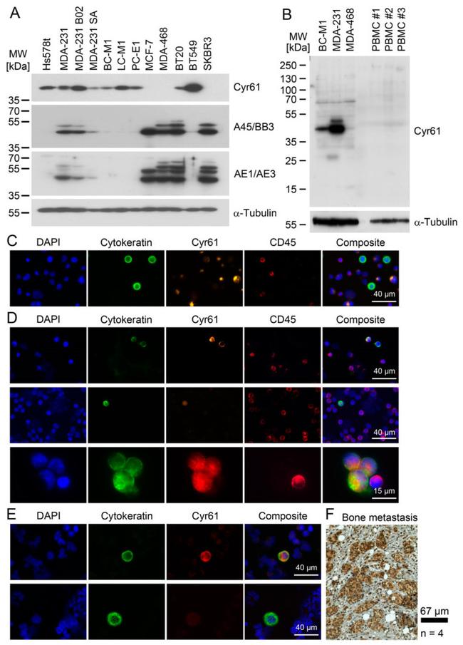 Pan Cytokeratin Antibody in Western Blot (WB)