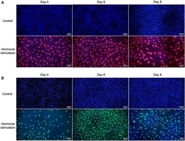 IL-33R (ST2) Antibody in Immunohistochemistry (IHC)