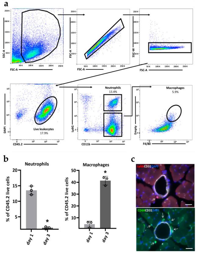 Ly-6G Antibody in Immunohistochemistry (IHC)