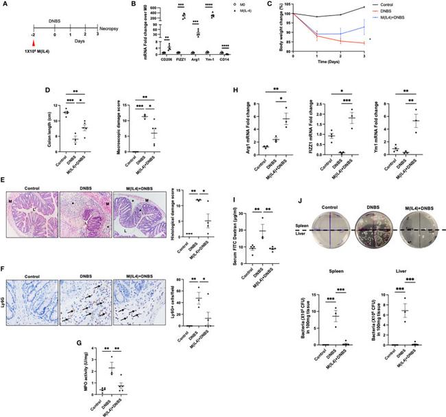 Ly-6G Antibody in Immunohistochemistry (IHC)