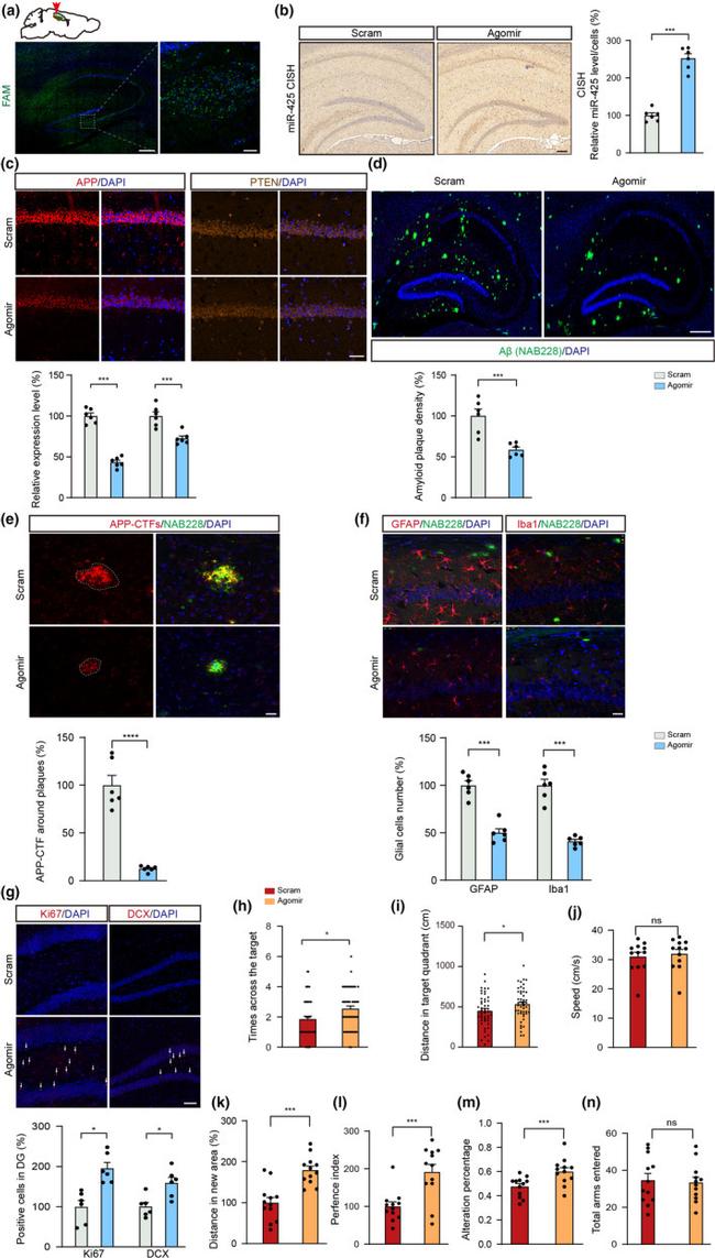 APP (Amyloid Precursor Protein) Antibody in Immunohistochemistry (IHC)