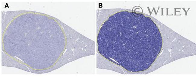 CD4 Antibody in Immunohistochemistry (IHC)