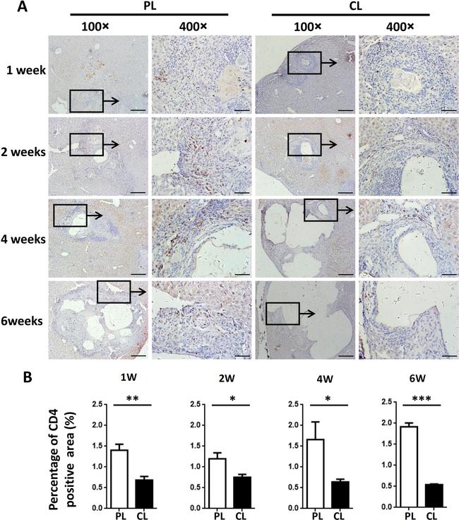 CD4 Antibody in Immunohistochemistry (IHC)