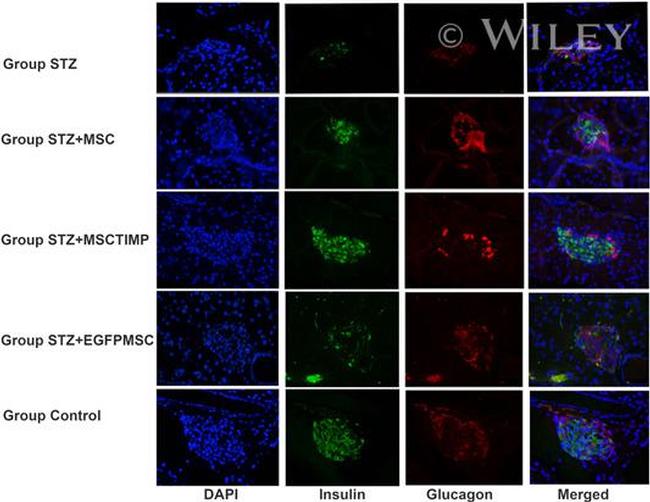 Insulin Antibody in Immunocytochemistry (ICC/IF)