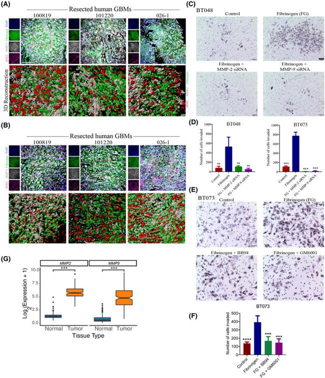 SOX2 Antibody in Immunocytochemistry (ICC/IF)