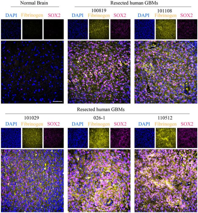 SOX2 Antibody in Immunocytochemistry (ICC/IF)