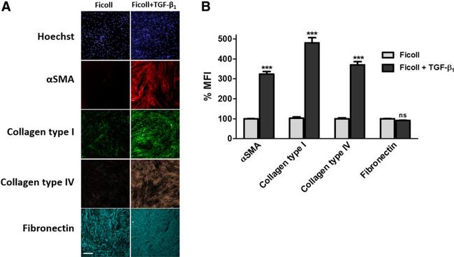 Fibronectin Antibody in Immunocytochemistry (ICC/IF)