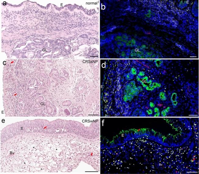 Vimentin Antibody in Immunohistochemistry (IHC)