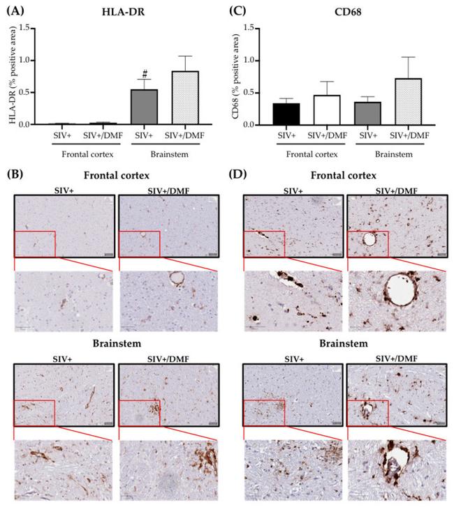 HLA-DR Antibody in Immunohistochemistry (IHC)