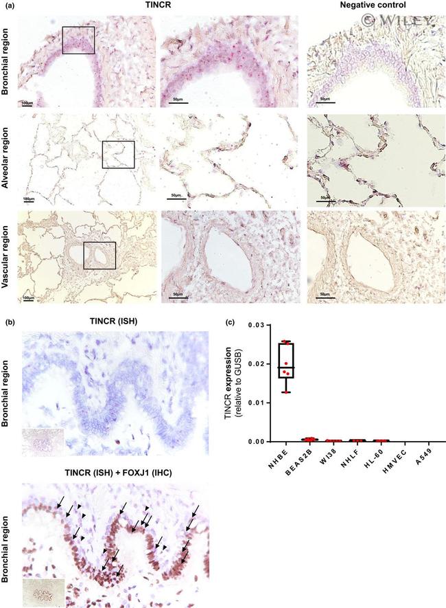 FOXJ1 Antibody in Immunohistochemistry (IHC)