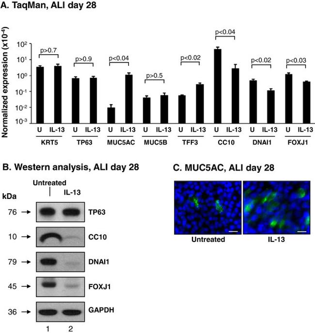 Cytokeratin 5 Antibody in Western Blot (WB)