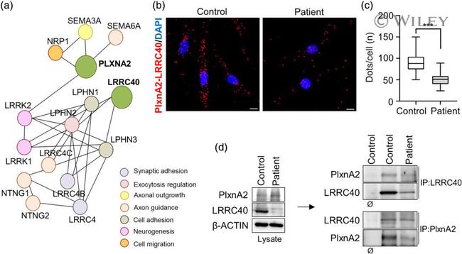 Plexin A2 Antibody in Western Blot, Immunocytochemistry, Immunoprecipitation (WB, ICC/IF, IP)