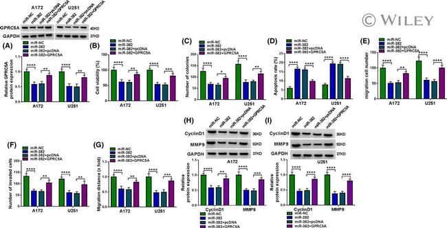 Cyclin D1 Antibody in Western Blot (WB)