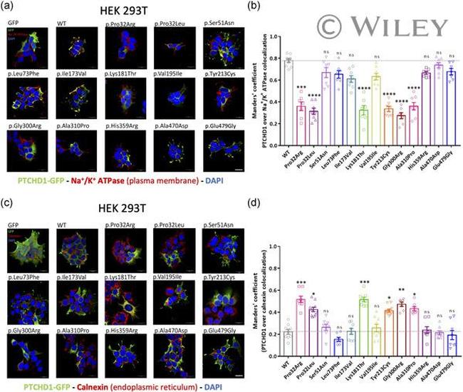 Calnexin Antibody in Immunocytochemistry (ICC/IF)