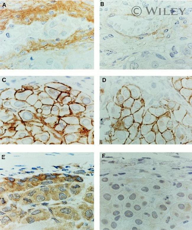 CD44std Antibody in Immunohistochemistry (IHC)