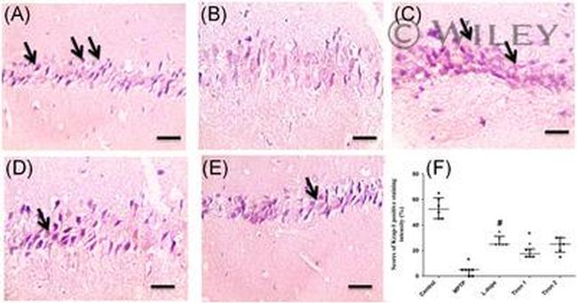 KEAP1 Antibody in Immunohistochemistry (IHC)