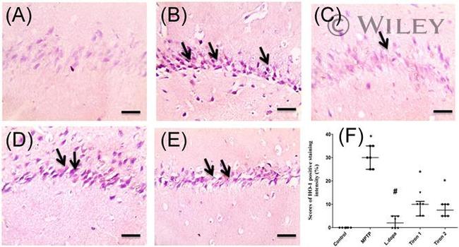 HO-1 Antibody in Immunohistochemistry (IHC)