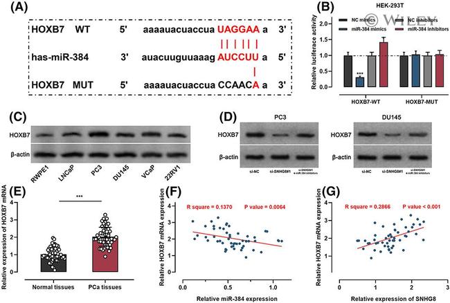 HOXB7 Antibody in Western Blot (WB)