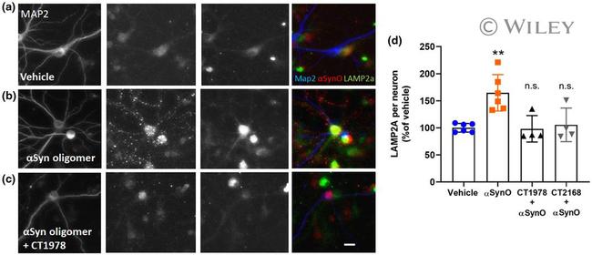 LAMP-2A Antibody in Immunocytochemistry (ICC/IF)