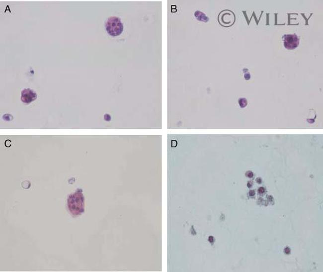 E-cadherin Antibody in Neutralization (Neu)