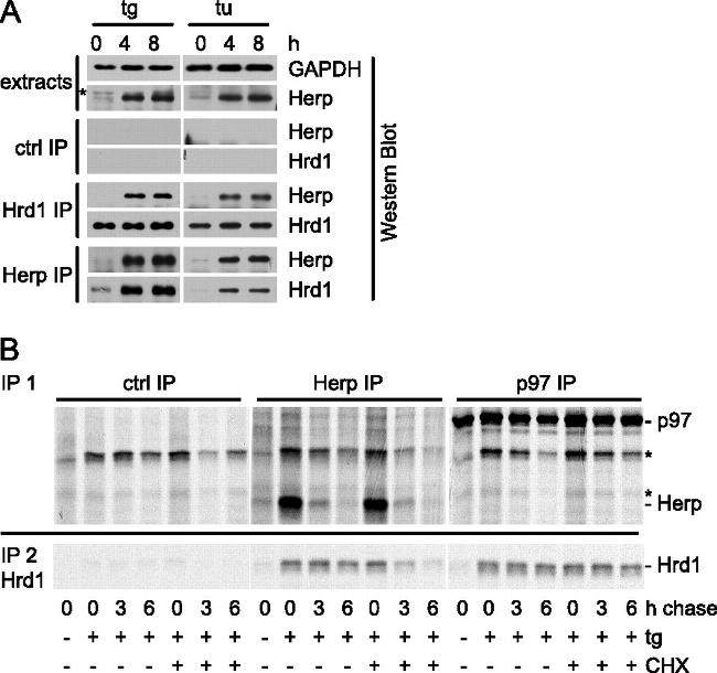 VCP Antibody in Immunoprecipitation (IP)