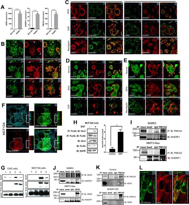 PMCA2 ATPase Antibody in Western Blot, Immunocytochemistry, Immunoprecipitation (WB, ICC/IF, IP)