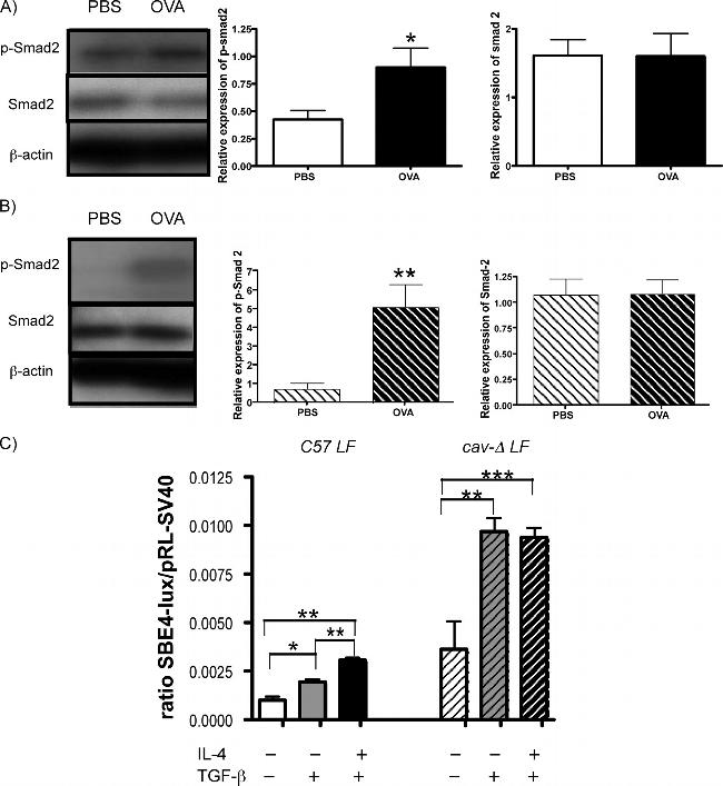 SMAD2 Antibody in Western Blot (WB)