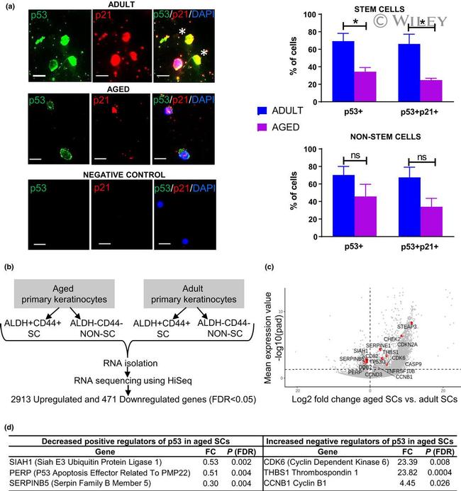 p21 Antibody in Immunocytochemistry (ICC/IF)