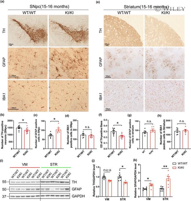 IBA1 Antibody in Immunohistochemistry (IHC)